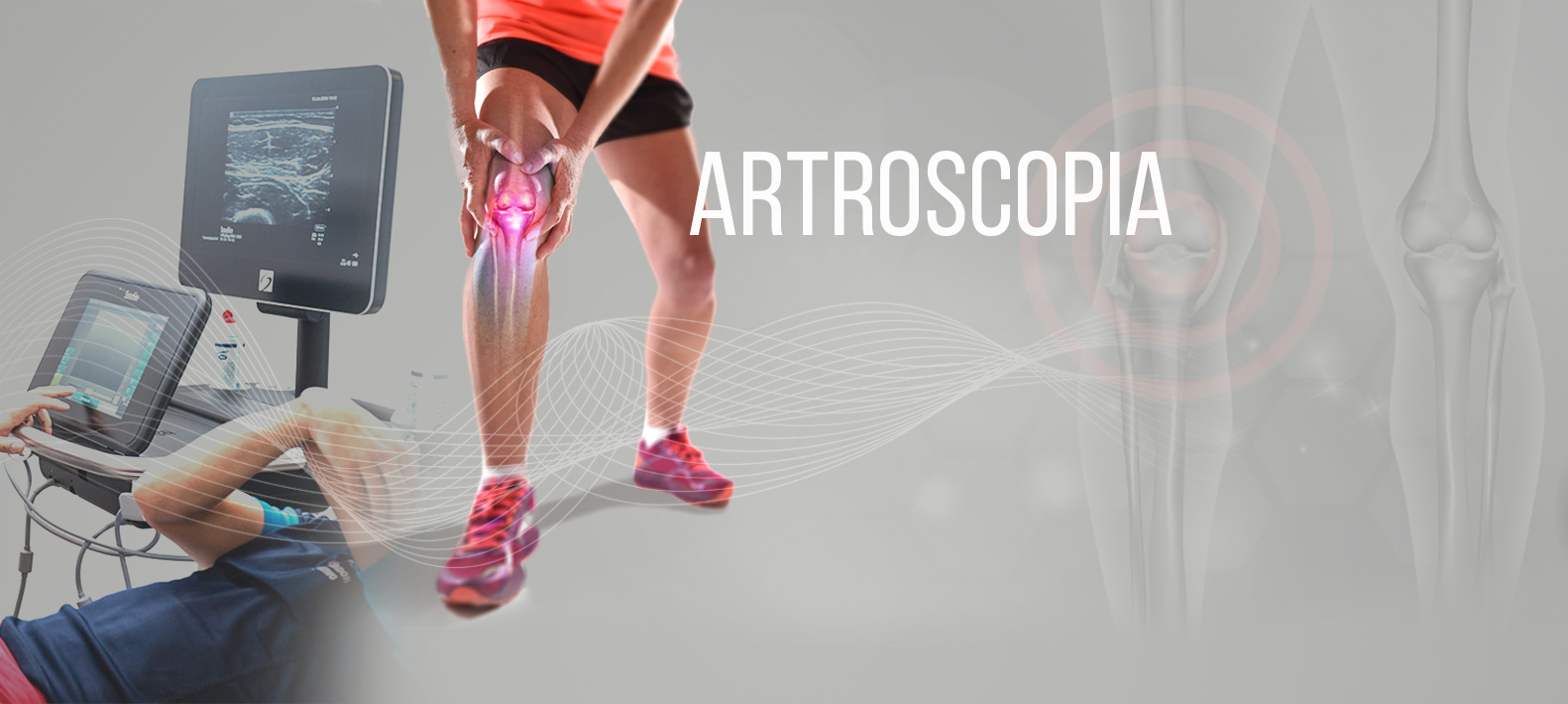 Artroscopia